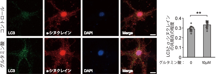 初代神経細胞においてグルタミン酸（10µM）処理によって神経活動を亢進させると、オートファゴソームのマーカーであるLC3（緑色）とα-シヌクレイン（赤色）の共局在（Merge画像における黄色）の程度が有意に増加します（スケールバー＝8µm）。